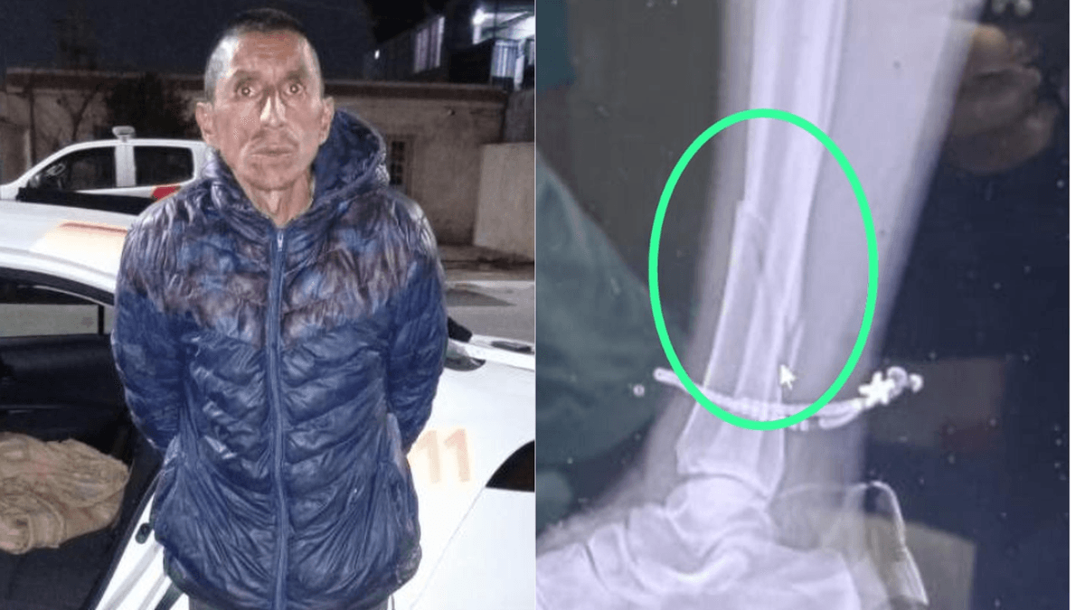 Tres años de prisión para el hombre que lanzó un ladrillo de casi dos kilos a su pareja, provocándole una fractura en la tibia